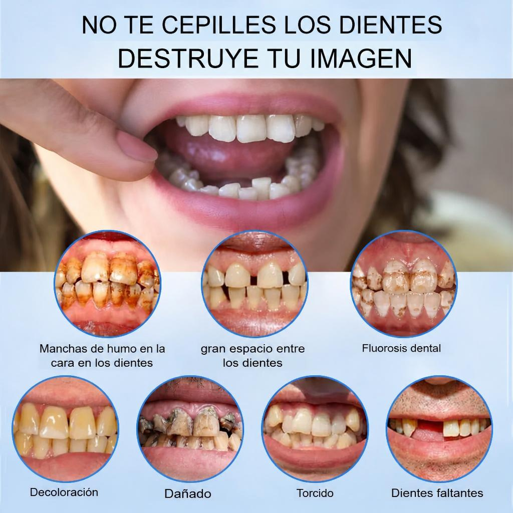Smile Easy ComfortDent™ 🦷 Prótesis Dental de Silicona Ajustable - SOLO HOY - LA SEGUNDA UNIDAD A MITAD DE PRECIO