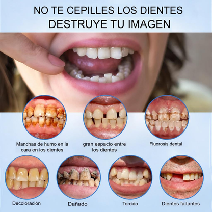Smile Easy ComfortDent™ 🦷 Prótesis Dental de Silicona Ajustable - SOLO HOY - LA SEGUNDA UNIDAD A MITAD DE PRECIO