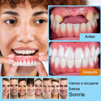 Smile Easy ComfortDent™ 🦷 Prótesis Dental de Silicona Ajustable - SOLO HOY - LA SEGUNDA UNIDAD A MITAD DE PRECIO