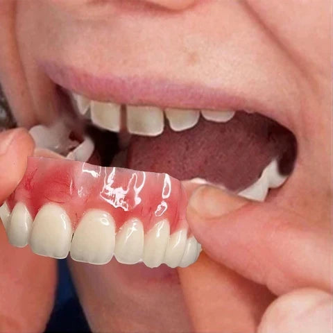 Smile Easy ComfortDent™ 🦷 Prótesis Dental de Silicona Ajustable - SOLO HOY - LA SEGUNDA UNIDAD A MITAD DE PRECIO